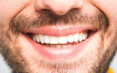 Candidiasis: ¿cómo se manifiestan los hongos en la boca?