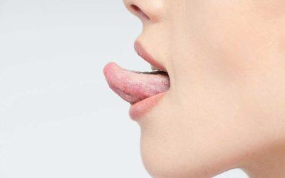 Leucoplasia oral: qué es, causas, diagnóstico y tratamiento