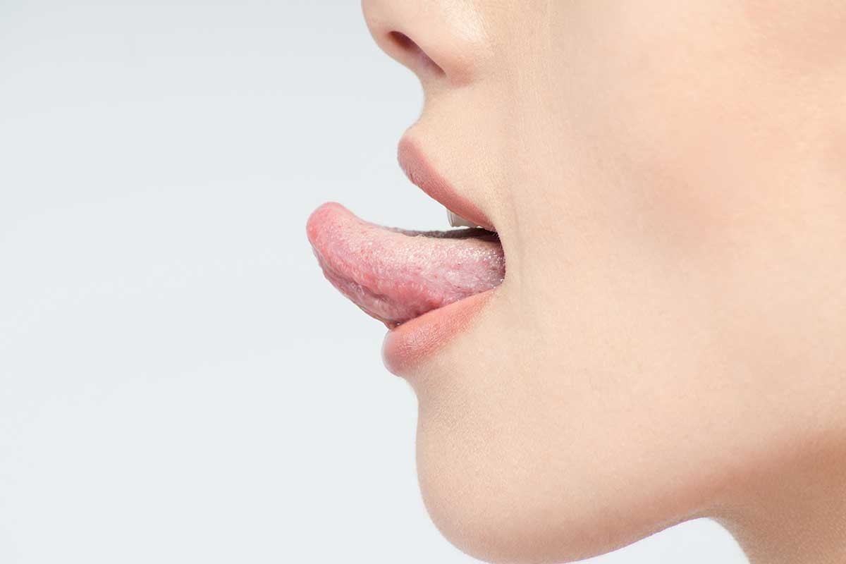 b2ap3_large_leucoplastia-oral-diagnostico-tratamiento-barcelona