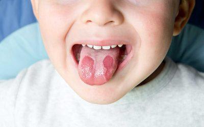 La lengua, un reflejo de nuestra salud general