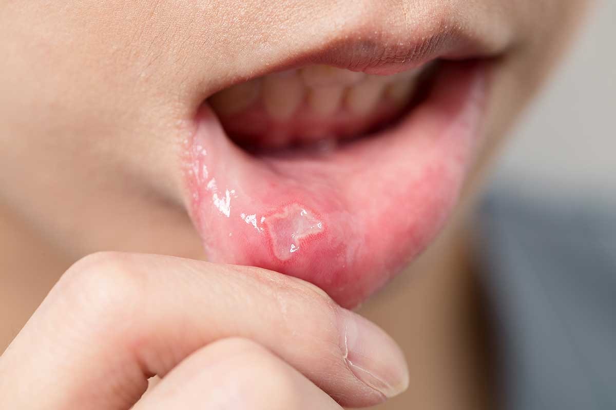 b2ap3_large_trastornos-digestivos-salud-bucal-patologias-