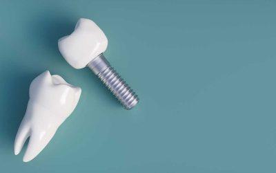 ¿Existen alternativas a los injertos de hueso?