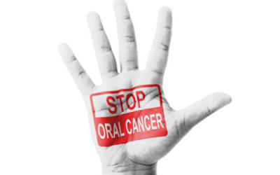 ¿Cómo prevenir el cáncer de boca?